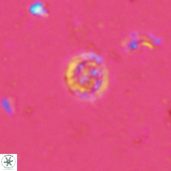 Prediscosphaera columnata VR 13920