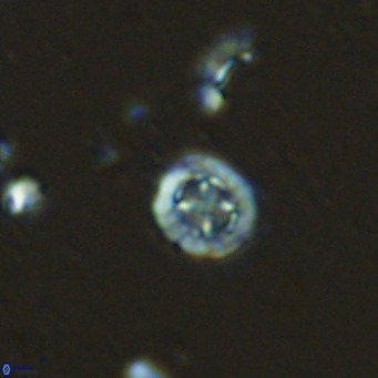 Prediscosphaera columnata VR 13921