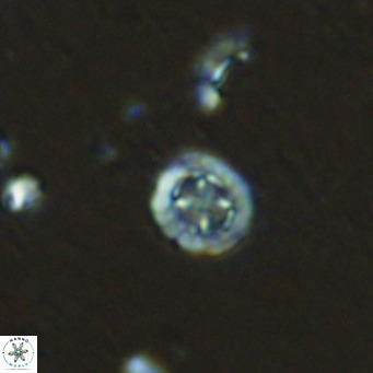 Prediscosphaera columnata VR 13921