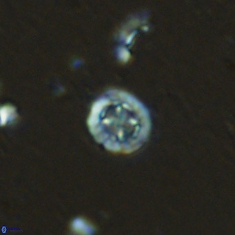 Prediscosphaera columnata VR 13922