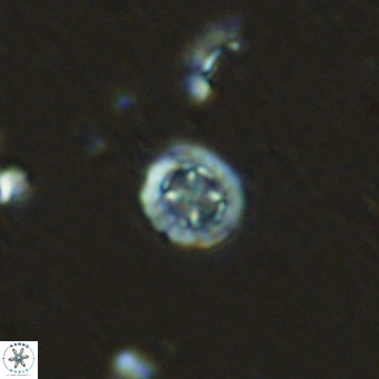 Prediscosphaera columnata VR 13922