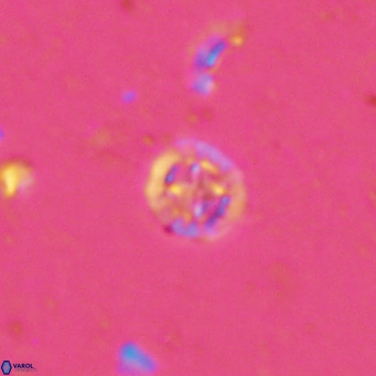 Prediscosphaera columnata VR 13923