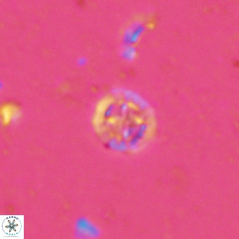 Prediscosphaera columnata VR 13923