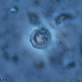 Prediscosphaera columnata VR 13930