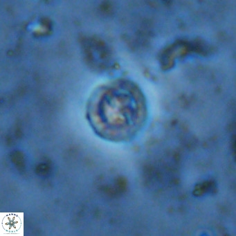Prediscosphaera columnata VR 13930