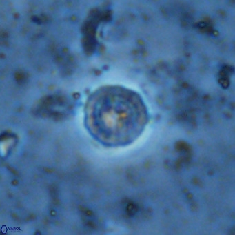 Prediscosphaera columnata VR 13931