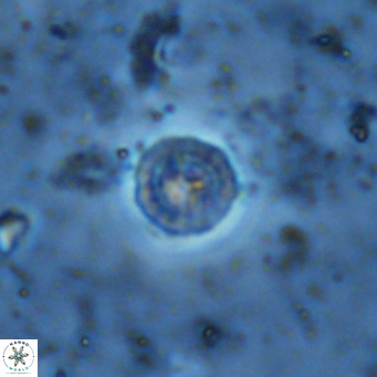 Prediscosphaera columnata VR 13931
