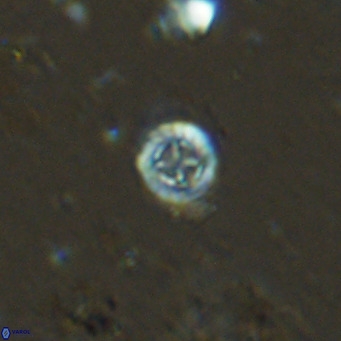 Prediscosphaera columnata VR 13966