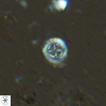 Prediscosphaera columnata VR 13966