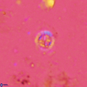 Prediscosphaera columnata VR 13967