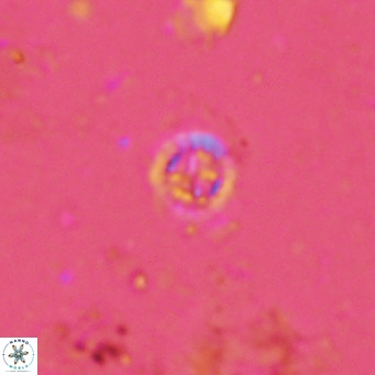 Prediscosphaera columnata VR 13967