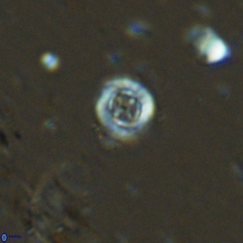 Prediscosphaera columnata VR 13962