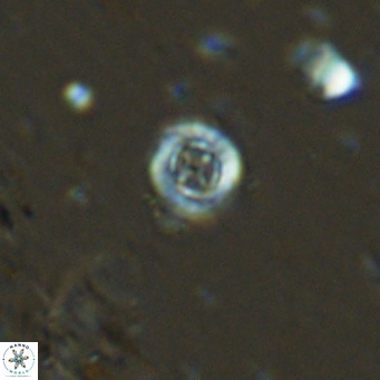 Prediscosphaera columnata VR 13962
