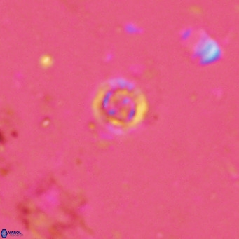 Prediscosphaera columnata VR 13963