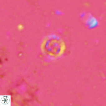 Prediscosphaera columnata VR 13963