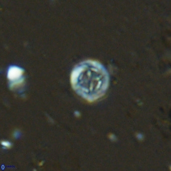 Prediscosphaera columnata VR 13970