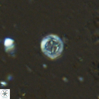 Prediscosphaera columnata VR 13970