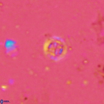 Prediscosphaera columnata VR 13971