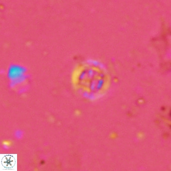 Prediscosphaera columnata VR 13971