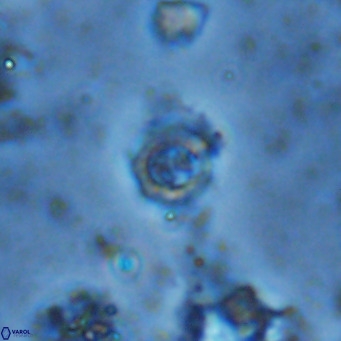 Prediscosphaera columnata VR 13987