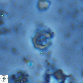 Prediscosphaera columnata VR 13987