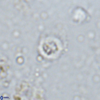 Prediscosphaera columnata VR 13982