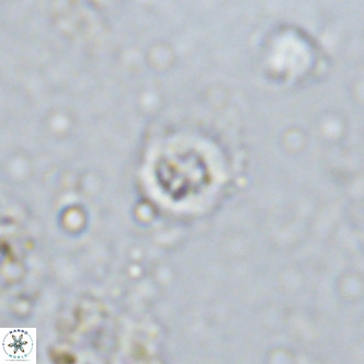 Prediscosphaera columnata VR 13982