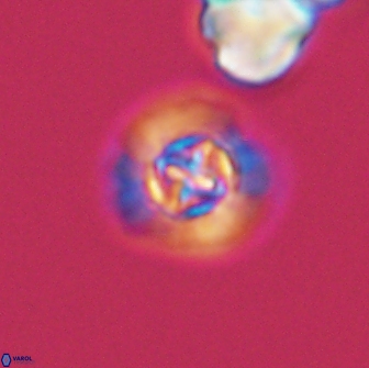 Prediscosphaera columnata 13598