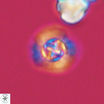Prediscosphaera columnata 13598