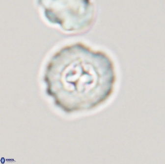 Prediscosphaera columnata 13599