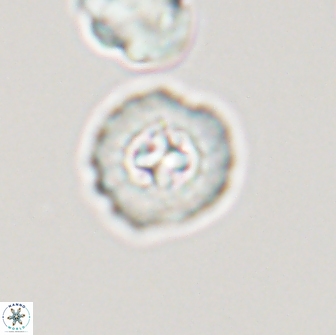 Prediscosphaera columnata 13599