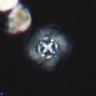Prediscosphaera columnata 13592