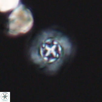 Prediscosphaera columnata 13592