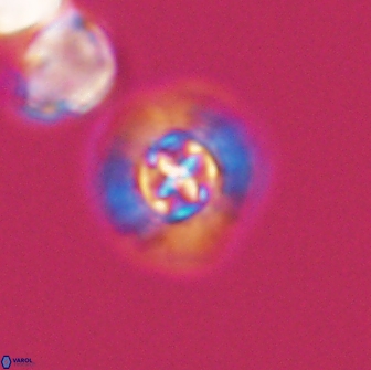 Prediscosphaera columnata 13593