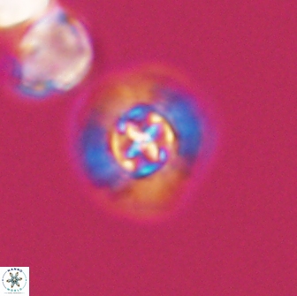 Prediscosphaera columnata 13593