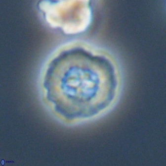 Prediscosphaera columnata 13600