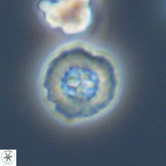 Prediscosphaera columnata 13600