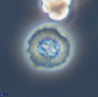 Prediscosphaera columnata 13601