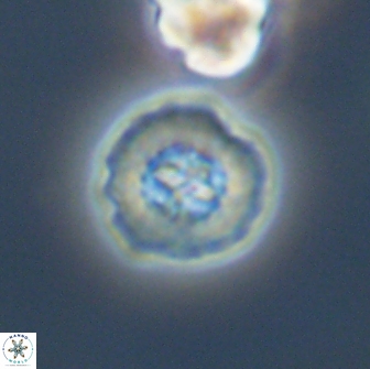 Prediscosphaera columnata 13601