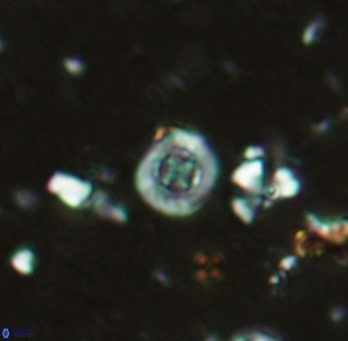 Prediscosphaera columnata 2253