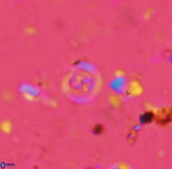 Prediscosphaera columnata 2254