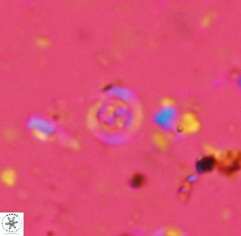 Prediscosphaera columnata 2254