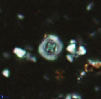 Prediscosphaera columnata 2255