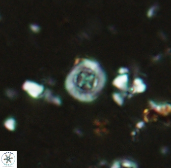 Prediscosphaera columnata 2255