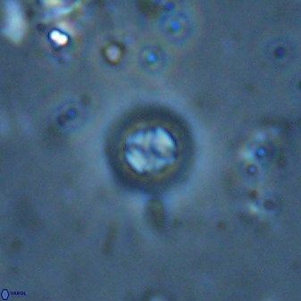 Prediscosphaera columnata 35634