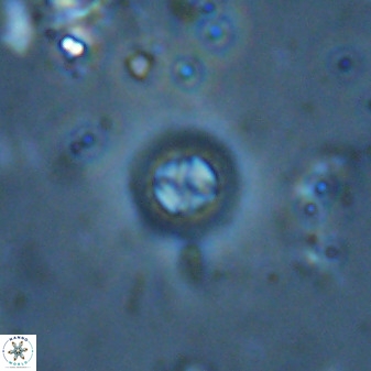 Prediscosphaera columnata 35634