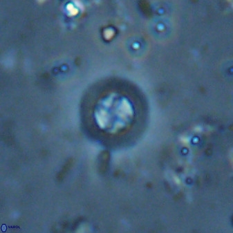 Prediscosphaera columnata 35635