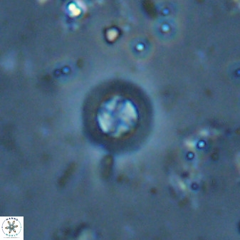 Prediscosphaera columnata 35635