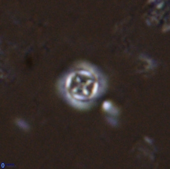 Prediscosphaera columnata 35630