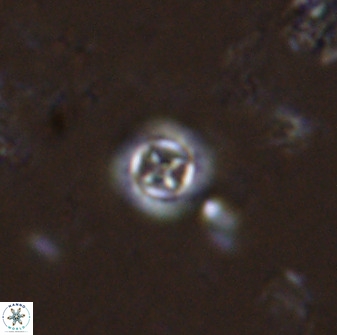 Prediscosphaera columnata 35630
